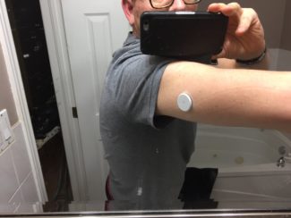 Me sporting my FreeStyle LIbre CGM.