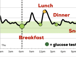 24 Hour Glucose Trend Line from my Abbott FreeStyle Libre CGM (Continuous Glucose Monitor). You can see the spikes in my blood sugar.