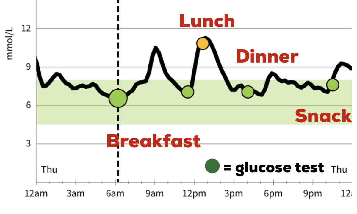 24 Hour Glucose Trend Line from my Abbott FreeStyle Libre CGM (Continuous Glucose Monitor). You can see the spikes in my blood sugar.